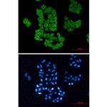 TCP-1 beta Recombinant Rabbit Monoclonal Antibody (K01_2L71)
