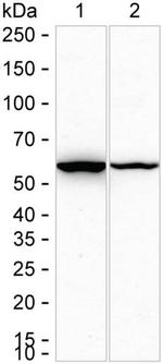 TCP-1 beta Antibody in Western Blot (WB)