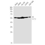 TCP-1 beta Antibody in Western Blot (WB)