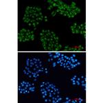 VAMP3 Antibody in Immunocytochemistry (ICC/IF)