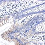 Clathrin Heavy Chain Recombinant Rabbit Monoclonal Antibody (K01_2L86)