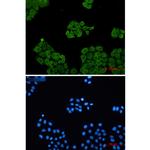 CLIC1 Antibody in Immunocytochemistry (ICC/IF)