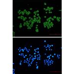 CLIP1 Recombinant Rabbit Monoclonal Antibody (K01_2L88)