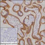 CLIP1 Antibody in Immunohistochemistry (Paraffin) (IHC (P))