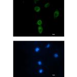 CLPX Recombinant Rabbit Monoclonal Antibody (K01_2L89)