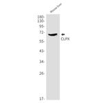 CLPX Antibody in Western Blot (WB)