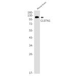CLSTN1 Antibody in Western Blot (WB)