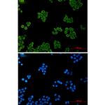CSDE1 Recombinant Rabbit Monoclonal Antibody (K01_2L94)