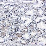 CSDE1 Antibody in Immunohistochemistry (Paraffin) (IHC (P))