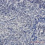 CtBP1 Antibody in Immunohistochemistry (Paraffin) (IHC (P))