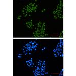 CtBP2 Recombinant Rabbit Monoclonal Antibody (K01_2L98)