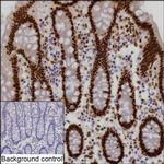 CtBP2 Antibody in Immunohistochemistry (Paraffin) (IHC (P))