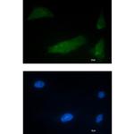 CUGBP1 Recombinant Rabbit Monoclonal Antibody (K01_2L99)