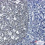 CUGBP1 Antibody in Immunohistochemistry (Paraffin) (IHC (P))