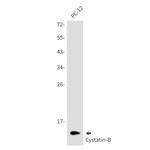 Cystatin B Antibody in Western Blot (WB)
