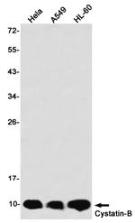 Cystatin B Antibody in Western Blot (WB)