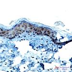 KRT9 Antibody in Immunohistochemistry (Paraffin) (IHC (P))