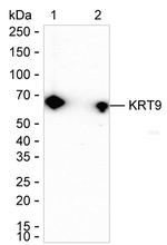 KRT9 Antibody in Western Blot (WB)