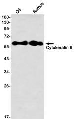 KRT9 Antibody in Western Blot (WB)
