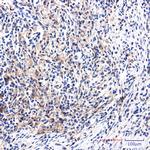 DAB2 Recombinant Rabbit Monoclonal Antibody (K01_2M07)