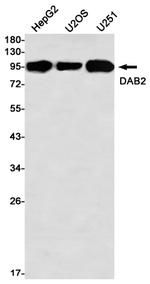 DAB2 Antibody in Western Blot (WB)
