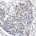 DDB1 Antibody in Immunohistochemistry (Paraffin) (IHC (P))