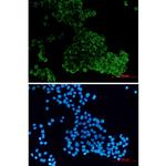 MADD Recombinant Rabbit Monoclonal Antibody (K01_2M10)