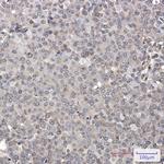 MADD Antibody in Immunohistochemistry (Paraffin) (IHC (P))