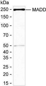 MADD Antibody in Western Blot (WB)