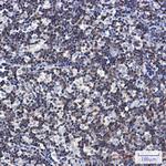 DGKA Recombinant Rabbit Monoclonal Antibody (K01_2M11)