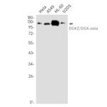 DGKZ Recombinant Rabbit Monoclonal Antibody (K01_2M12)