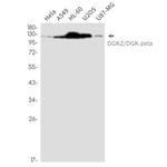 DGKZ Recombinant Rabbit Monoclonal Antibody (K01_2M13)