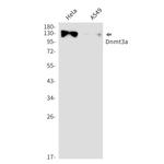 DNMT3A Recombinant Rabbit Monoclonal Antibody (K01_2M16)