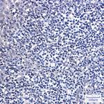 DTYMK Recombinant Rabbit Monoclonal Antibody (K01_2M17)