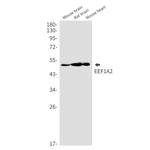 EEF1A2 Recombinant Rabbit Monoclonal Antibody (K01_2M20)