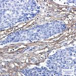 Fibulin 3 Recombinant Rabbit Monoclonal Antibody (K01_2M22)