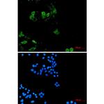 KIF11 Antibody in Immunocytochemistry (ICC/IF)