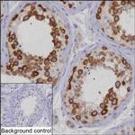 KIF11 Antibody in Immunohistochemistry (Paraffin) (IHC (P))