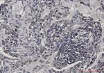 eIF4B Antibody in Immunohistochemistry (Paraffin) (IHC (P))