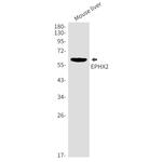 EPHX2 Antibody in Western Blot (WB)