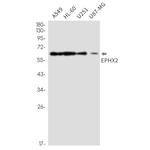EPHX2 Recombinant Rabbit Monoclonal Antibody (K01_2M28)