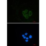 EPS15R Recombinant Rabbit Monoclonal Antibody (K01_2M29)