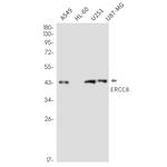 ERCC8 Recombinant Rabbit Monoclonal Antibody (K01_2M32)
