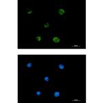 FADS1 Recombinant Rabbit Monoclonal Antibody (K01_2M37)