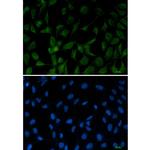 Fe65 Recombinant Rabbit Monoclonal Antibody (K01_2M38)