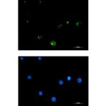 FGFR1OP Recombinant Rabbit Monoclonal Antibody (K01_2M39)