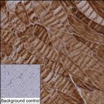 FHL1 Recombinant Rabbit Monoclonal Antibody (K01_2M41)