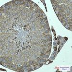 FKBP6 Recombinant Rabbit Monoclonal Antibody (K01_2M43)