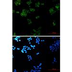 gamma Catenin Antibody in Immunocytochemistry (ICC/IF)