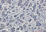 gamma Catenin Antibody in Immunohistochemistry (Paraffin) (IHC (P))